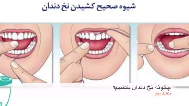 بهترین روش نخ دندان کشیدن + تصاویر