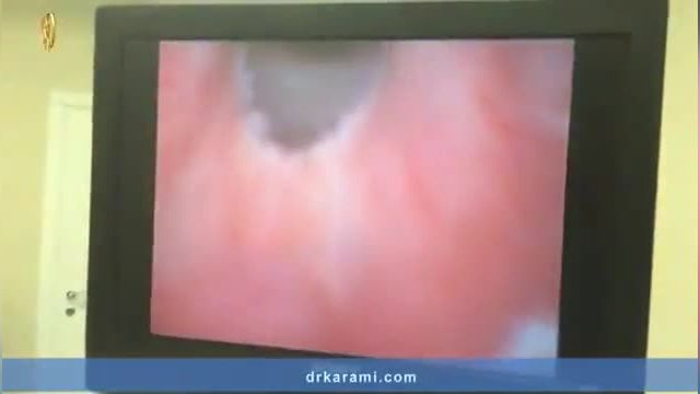 ویدیوی TURP یا جراحی پروستات بدون شکاف