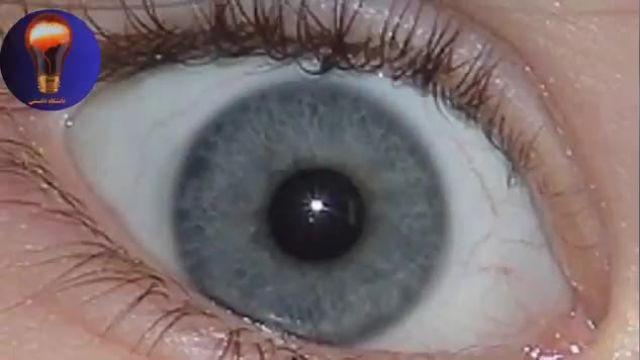 کمیاب ترین  رنگ  چشم ها در جهان