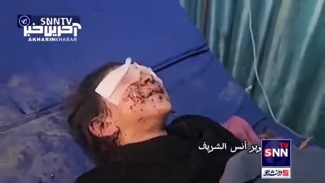 تصویری دردناک از زخمی شدن یک کودک در پی حملات رژیم صهیونیستی