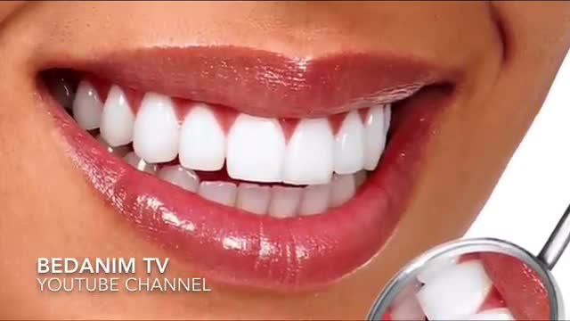 سریترین راه جرم گیری و سفید کردن دندان‌ های زرد به روش خانگی