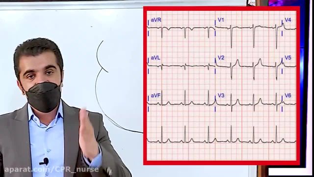 وبینار آموزش کامل سکته قلبی STE MI | قسمت هشتم