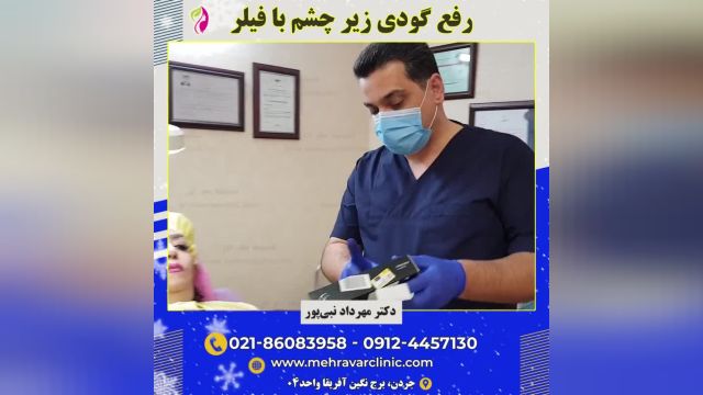 رفع گودی زیر چشم ها با تزریق فیلر