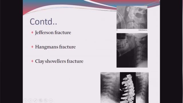 رادیولوژی و تصویربرداری | اسکلت تروما (Skeletal Truma)