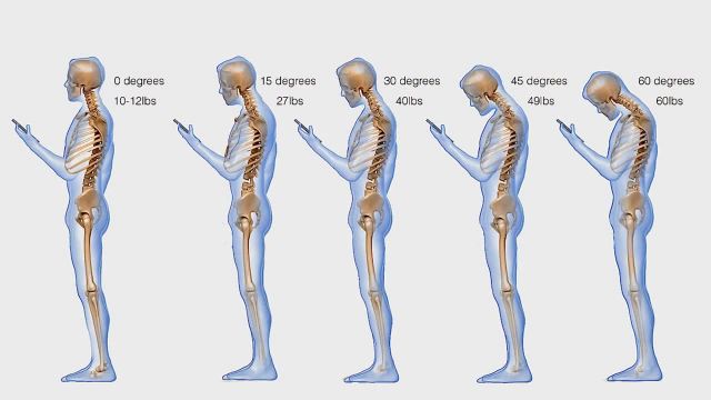 آموزش تمرینات فیزیوتراپی درد گردن و تقویت عضلات گردن در خانه