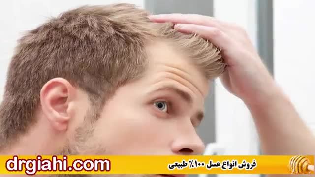 درمان قطعی ریزش مو به طور طبیعی و رویش مجدد موی سر