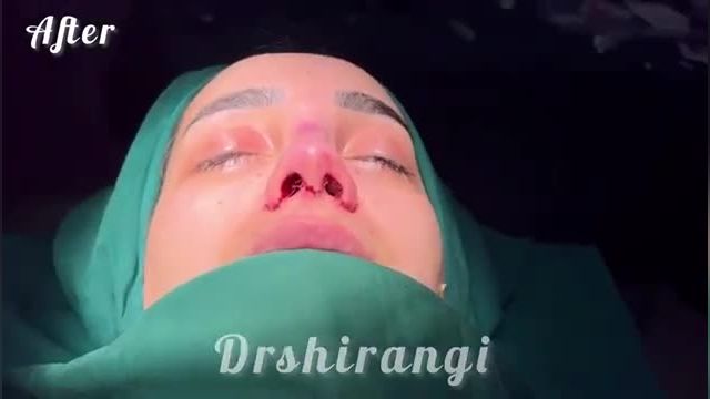 جراح بینی با رتبه برتر در تهران
