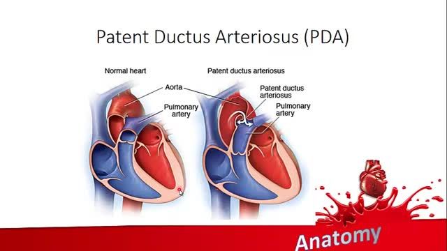 جنین شناسی دستگاه قلب و عروق | آموزش علوم تشریح آناتومی قلب و عروق | جلسه هفتم (7)