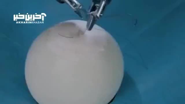آماده سازی ربات جراحی پزشکی | ویدیو
