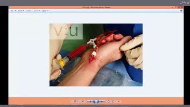 وبینار آنالیز موج های CVP و Arterial line بیماران Cerve ABP | دوره پرستاری در بخش ICU-OH (جلسه 4 از 10)