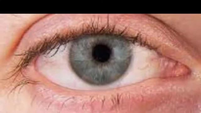 هر آنچه درباره خشکی چشم از علت تا درمان آن باید بدانید!