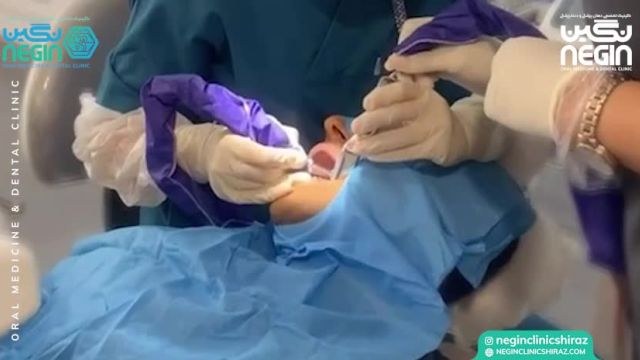 جراحی ایمپلنت SIC | کلینیک دندانپزشکی نگین
