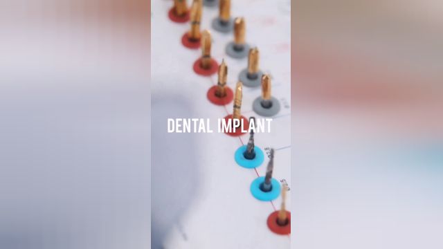 کاشت دندان با ایمپلنت مشهد در بهترین کلینیک دندانپزشکی