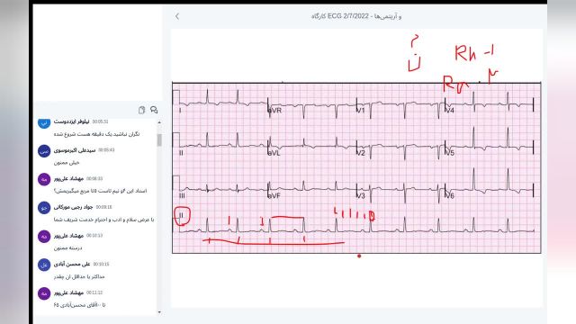 کارگاه جامع و کامل ECG و آریتمی‌ ها (جلسه 2/5)