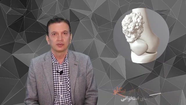 تومور های استخوان و مفاصل از زبان دکتر محمود جعفر بیگلو