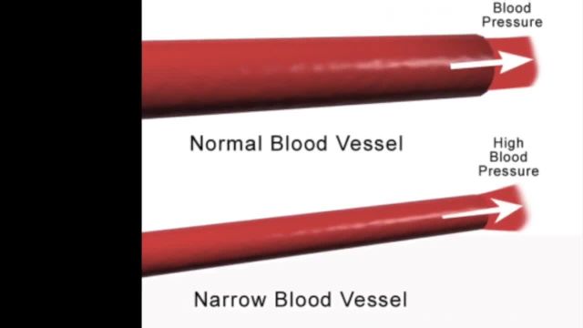 روش های پایین آوردن فشار خون بالا | ویدیو