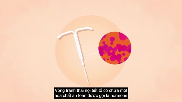 درباره پیشگیری از بارداری در ویتنام