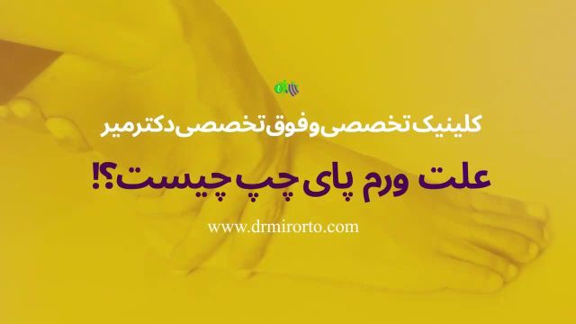 ورم پای چپ چیست و چه عواملی موجب ورم پا خواهد شد؟