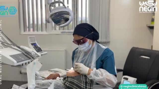 برداشتن ضایعه دهانی با لیزر در شیراز | متخصص دهان پزشکی