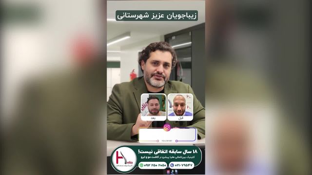 کلینیک هلیا، انتخاب اول برای هرکسی که کاشت مو برایش مهم است!