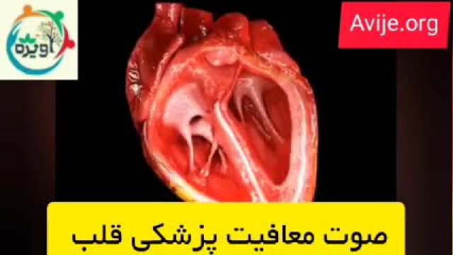 معافیت سربازی برای بیماران دارای مشکل قلبی