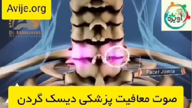 نحوه دریافت معافیت دیسک گردن