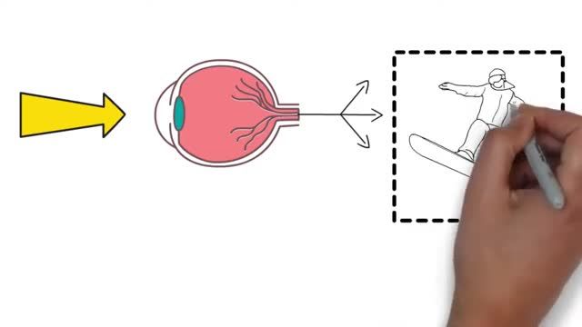 چگونه جراحی لیزر چشم از مراحل آزمایشی گذشته و تبدیل به روش بهبود یافته شده