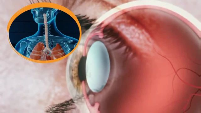 اهمیت مصرف ویتامین و مواد معدنی برای خشکی و خارش و تقویت چشم