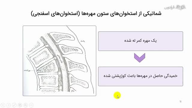 دوره آموزش فیزیک پزشکی - نکته و حل تست کنکور ارشد - کاربرد فیزیک جامدات در بدن