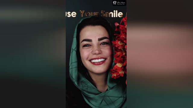 فیلم لمینت سرامیکی دندان کلینیک دکتر نوشین نصیری