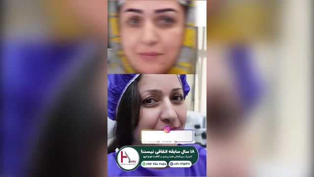 ابروهایی پرپشت و خوش فرم با جدیدترین روش‌های روز