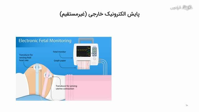 آموزش تفسیر کامل نوار قلب جنین (NST)