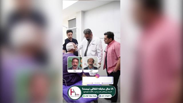 مشاوره تخصصی: گام اول برای کاشت موی موفق