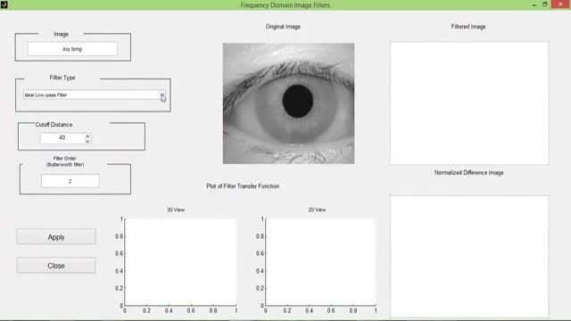 ‫پروژه فیلتر تصویر در حوزه فرکانس برای عنبیه چشم با MATLA‬‎