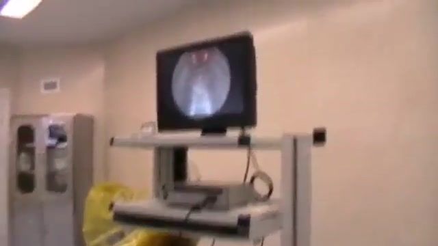 ‫درمان سنگ بزرگ مثانه به روش اندوسکوپی توسط دکتر حسین کرمی‬‎