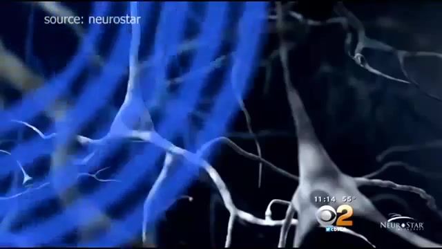 درمان افسردگی اساسی با تحریک مغناطیسی مغز