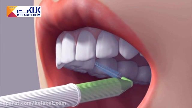 آموزش استفاده از موثرترین روش مسواک بین دندانی