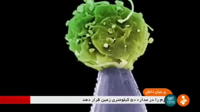 Iran Eye Diseases treatment using Stem cell کاربرد سلول های بنیادی درمان بیماریهای چشم ایران