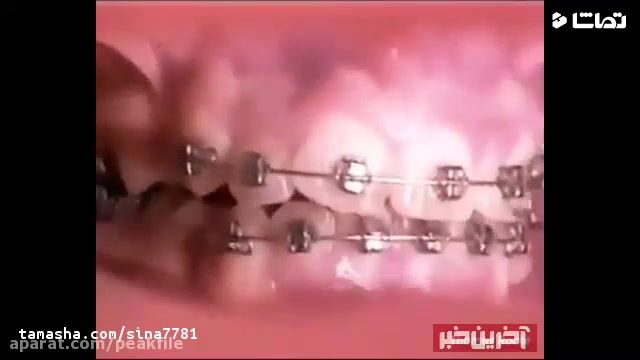 ارتودنسی دندان | کلینیک دندانپزشکی