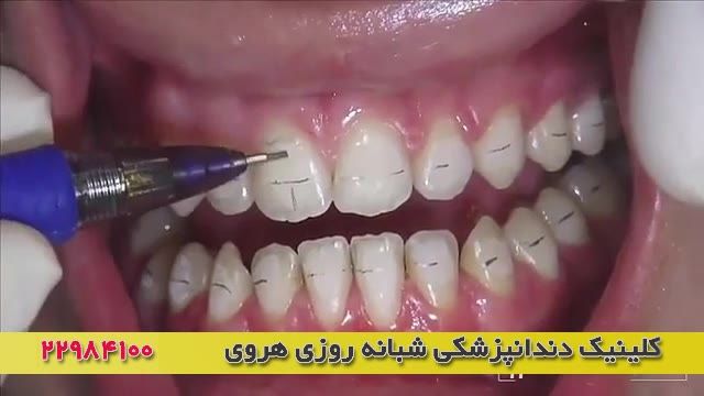 ارتودنسی دندان ها نیاز به مهارت و دقت بسیار بالای متخصص ارتودنسی دارد