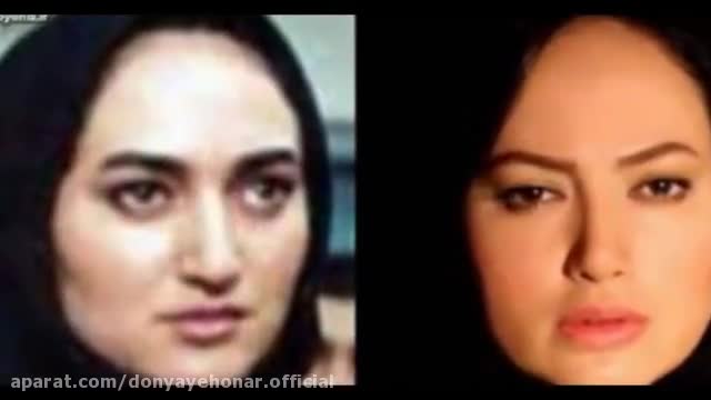 جراحی بینی بازیگران ایرانی