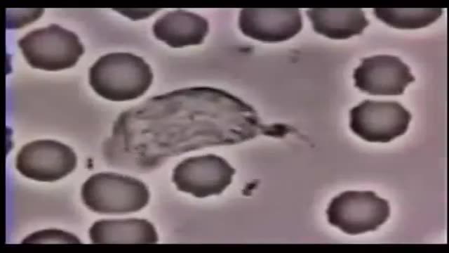 تعقیب باکتری توسط گلبول سفید و حمله به آن