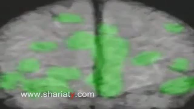 ‫ساختار مغز انسان‬‎