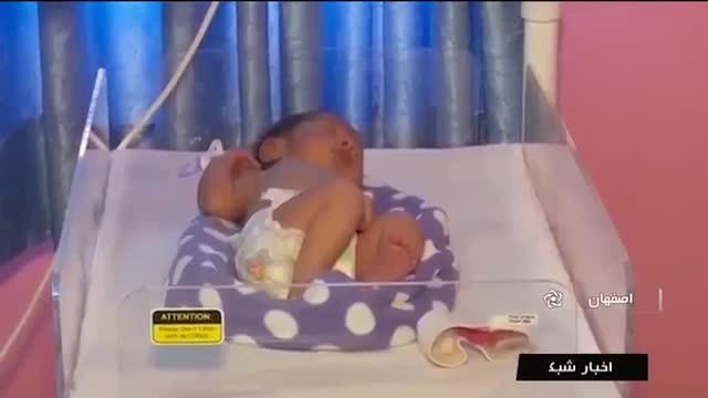 Iran Imam Hussein Children hospital, Isfahan city بیمارستان کودکان امام حسین اصفهان ایران