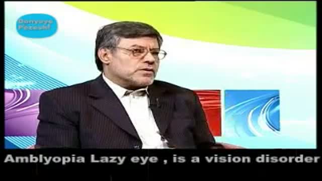 Amblyopia Lazy eye and treatment. تنبلی چشم و درمان