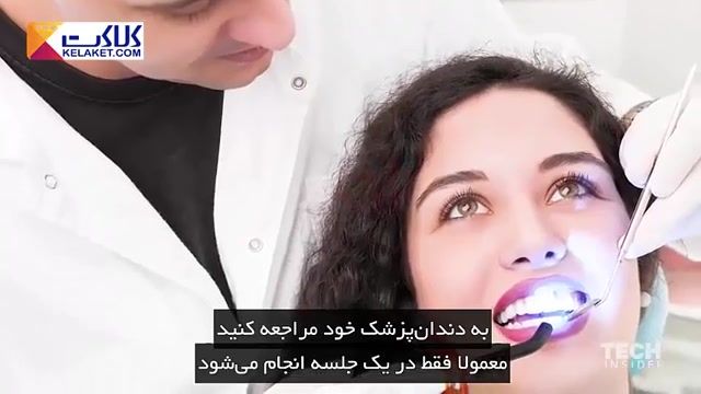 توصیه های یک دندانپزشک برای سفید کردن دندان ها