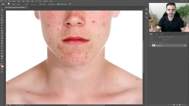 حذف جوش، خال و لکه در فتوشاپ - How to Remove Pimple in Photoshop