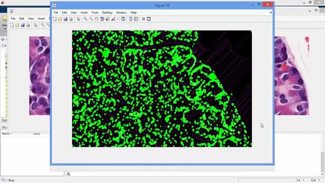 ‫فیلم پروژه قطعه بندی سلول ها از تصاویر در نرم افزار MATLAB‬‎