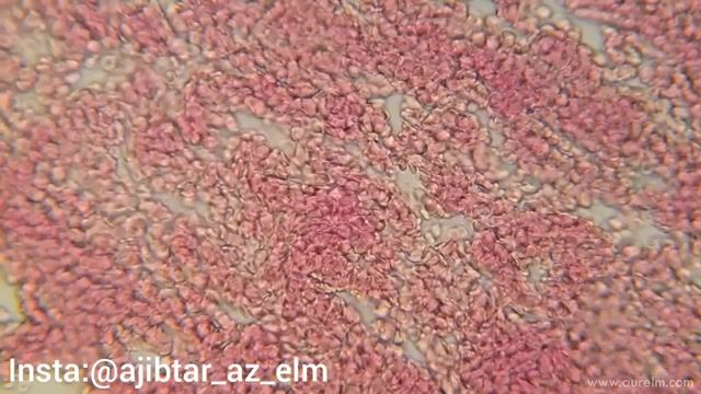 خون انسان در زیر میکروسکوپ