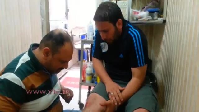 ضرب و شتم بیمار در حین بخیه زدن توسط پزشک